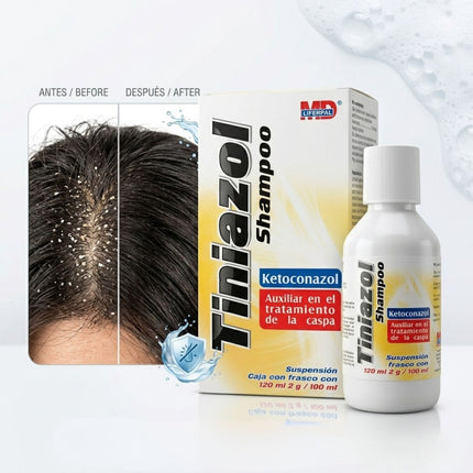 Tiniazol Shampoo (Ketoconazol) 2g/100 mL Frasco con 120 mL